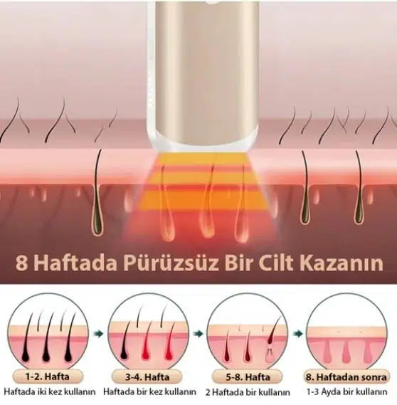 EZERE IPL Buz Lazer Epilasyon 999.999 Atim Otomatik/manuel Dokunmatik Ekran Agrisiz Vücut Yüz Cihazi EZERE IPL Buz Lazer Epilasyon 999.999 Atim Otomatik/manuel Dokunmatik Ekran Agrisiz Vücut Yüz Cihazi